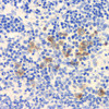 Immunohistochemistry analysis of paraffin-embedded rat spleen  using ROCK1 Polyclonal Antibody at dilution of 1:300.