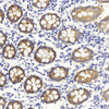 Immunohistochemistry analysis of paraffin-embedded human colon  using Claudin 5 Polyclonal Antibody at dilution of 1:400.