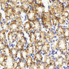 Immunohistochemistry analysis of paraffin-embedded human stomach  using Claudin 5 Polyclonal Antibody at dilution of 1:400.