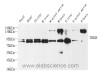 Western Blot analysis of various samples using NTRK2 Polyclonal Antibody at dilution of 1:1000.