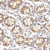 Immunohistochemistry analysis of paraffin-embedded human colon  using IL22RA1 Polyclonal Antibody at dilution of 1:200.