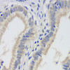 Immunohistochemistry analysis of paraffin-embedded human gallbladder   using FAS Monoclonal Antibody at dilution of 1:200.