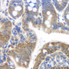 Immunohistochemistry analysis of paraffin-embedded mouse colon   using FAS Monoclonal Antibody at dilution of 1:200.