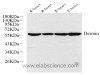 Western Blot analysis of various samples using Desmin Polyclonal Antibody at dilution of 1:1000.