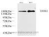 Western Blot analysis of various samples using ERBB2 Polyclonal Antibody at dilution of 1:1000.