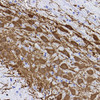 Immunohistochemistry analysis of paraffin-embedded rat substantia nigra  using TH Monoclonal Antibody at dilution of 1:1000.