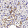 Immunohistochemistry analysis of parafffin-embedded mouse kidney  using NOX4 Polyclonal Antibody at dilution of 1:400.