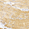 Immunohistochemistry analysis of parafffin-embedded rat skeletal muscle  using Desmin Monoclonal Antibody at dilution of 1:300.