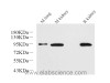 Western Blot analysis of various samples using Catenin beta Monoclonal Antibody at dilution of 1:1000.