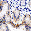 Immunohistochemistry analysis of paraffin-embedded Human colon  using Catenin beta Monoclonal Antibody at dilution of 1:200.