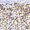 Immunohistochemistry analysis of paraffin-embedded Rat stomach  using Catenin beta Monoclonal Antibody at dilution of 1:200.