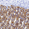 Immunohistochemistry analysis of paraffin-embedded rat stomach  using CK-19 Monoclonal Antibody at dilution of 1:1000.