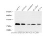 Western Blot analysis of various samples using Histone H2A.X Polyclonal Antibody at dilution of 1:1000.