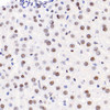 Immunohistochemistry analysis of paraffin-embedded mouse liver  using HDAC2 Polyclonal Antibody at dilution of 1:1000.