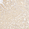 Immunohistochemistry analysis of paraffin-embedded mouse stomach cancer  using CK-7 Monoclonal Antibody at dilution of 1:300.