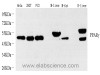 Western Blot analysis of various samples using PPARG Polyclonal Antibody at dilution of 1:1500.