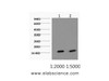 Western Blot analysis of Hela cells using COX4I1 Monoclonal Antibody at dilution of 1) 1:2000 2) 1:5000.