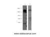 Western Blot analysis of 1) Hela, 2) Mouse brain using ERBB2 Monoclonal Antibody at dilution of 1:4000.