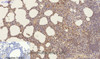 Immunohistochemistry of paraffin-embedded Mouse lung tissue using CD23 Monoclonal Antibody at dilution of 1:200.