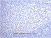 Immunohistochemistry of paraffin-embedded Human tonsil tissue using CD68 Monoclonal Antibody at dilution of 1:200.
