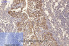 Immunohistochemistry of paraffin-embedded Human tonsil tissue using CK-16 Monoclonal Antibody at dilution of 1:200.