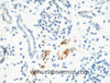Immunohistochemistry of paraffin-embedded Mouse kidney tissue using KIF7 Monoclonal Antibody at dilution of 1:200.
