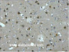 Immunohistochemistry of paraffin-embedded Human brain tissue using MAP2 Monoclonal Antibody at dilution of 1:200.