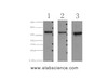 Western Blot analysis of 1) 293T, 2) HepG2, 3) Hela cells using FH Monoclonal Antibody at dilution of 1:3000.