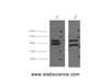 Western Blot analysis of 1) Hela, 2) HepG2 cells using IDE Monoclonal Antibody at dilution of 1:2000.