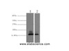 Western Blot analysis of 1) Human Milk, 2) Milk using alpha Lactalbumin Monoclonal Antibody at dilution of 1:3000.