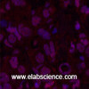 Immunofluorescence analysis of Human breast cancer tissue using Oct-1/2 Monoclonal Antibody at dilution of 1:200.