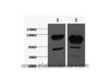 Western Blot analysis of 1) Jurkat, 2) Hela cells using Cleaved PARP1 Monoclonal Antibody at dilution of 1:2000.