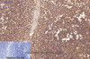 Immunohistochemistry of paraffin-embedded Human tonsil tissue using CD1A Monoclonal Antibody at dilution of 1:200.
