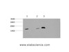 Western Blot analysis of 1) Hela, 2) 3T3, 3) Rat brain using MAP1LC3A Monoclonal Antibody at dilution of 1:1000.