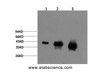 Western Blot analysis of 1) Hela, 2)Mouse brain, 3) Rat brain using ERK 1/2 Monoclonal Antibody at dilution of 1:2000.