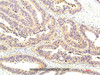 Immunohistochemistry of paraffin-embedded Human colon tissue using STAT1 Monoclonal Antibody at dilution of 1:200.