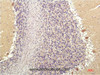 Immunohistochemistry of paraffin-embedded Human brain tissue using SGK1 Monoclonal Antibody at dilution of 1:200.