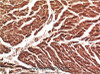 Immunohistochemistry of paraffin-embedded Human heart tissue using VE-Cadherin Monoclonal Antibody at dilution of 1:200.