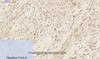 Immunohistochemistry of paraffin-embedded Human uterus tissue with Phospho-ERK 1/2 (Tyr204) Polyclonal Antibody at dilution of 1:200