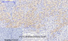 Immunohistochemistry of paraffin-embedded Mouse kidney tissue  using Phospho-IkB alpha (Ser32/S36) Polyclonal Antibody at dilution of 1:200