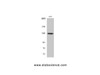 Western Blot analysis of A549 cells with Phospho-JAK1 (Tyr1022) Polyclonal Antibody at dilution of 1:500