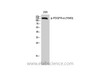 Western Blot analysis of 293 cells with Phospho-PDGFRA (Tyr849) Polyclonal Antibody