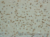 Immunohistochemistry of paraffin-embedded mouse brain  using Phospho-AMPK alpha1/2 (Thr183/172) Polyclonal Antibody at dilution of 1:50