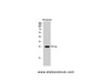 Western Blot analysis of His protein using His-tag Polyclonal Antibody at dilution of 1:2000.