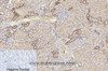 Immunohistochemistry of paraffin-embedded Human kidney tissue using Cleaved-CASP8 (D384) Polyclonal Antibody at dilution of 1:200.