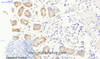 Immunohistochemistry of paraffin-embedded Human stomach tissue using JAK3 Polyclonal Antibody at dilution of 1:200.