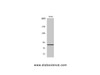 Western Blot analysis of HuvEc cells using Mfn2 Polyclonal Antibody at dilution of 1:1000.