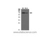 Western Blot analysis of KB, Hela cells using Nrf2 Polyclonal Antibody at dilution of 1:1000.