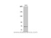 Western Blot analysis of HuvEc cells using Nrf2 Polyclonal Antibody at dilution of 1:1000.