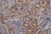 Immunohistochemistry of paraffin-embedded Rat kidney using PDGFRB Polyclonal Antibody at dilution of 1:50